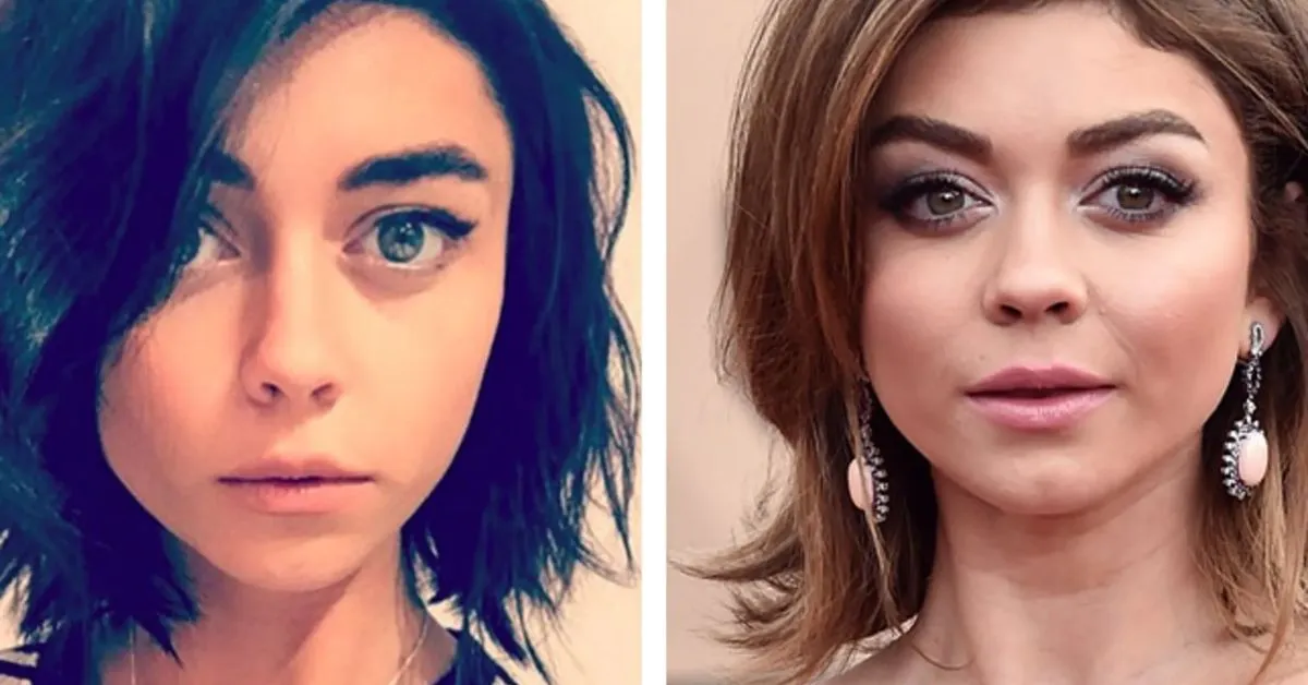 Sarah Hyland Plastic Surgery