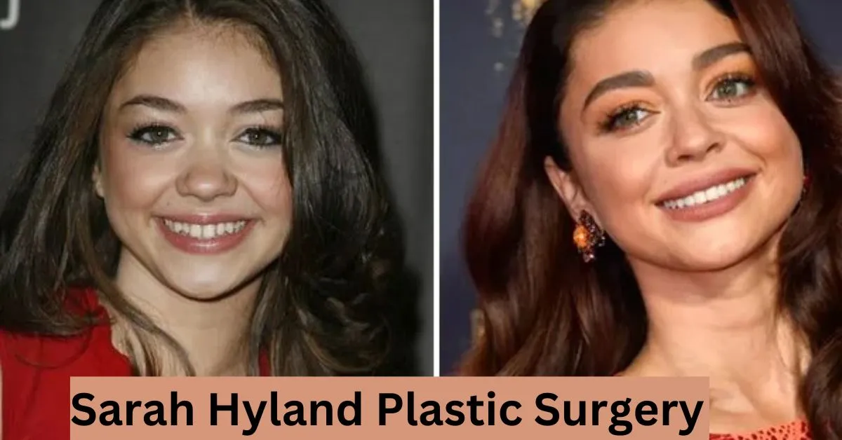 Sarah Hyland Plastic Surgery